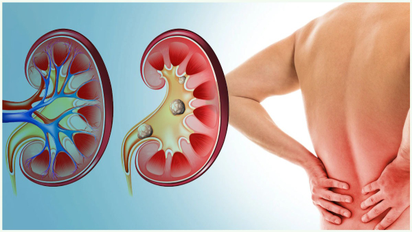 Warning Signs Of Kidney Infection In Tamil 