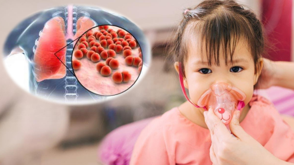 Mysterious Children Pneumonia Outbreak In China: All You Need To Know In Tamil