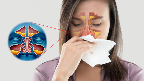 Chennai Rain: Home Remedies to Treat Sinusitis Naturally In Tamil