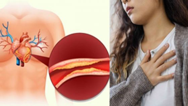 Why LDL Levels Increase In Women in Their 40s in Tamil