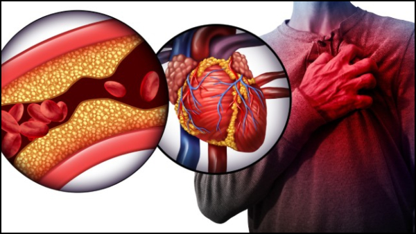 Winter Heart Attack Symptoms That Only Appears at Night In Tamil