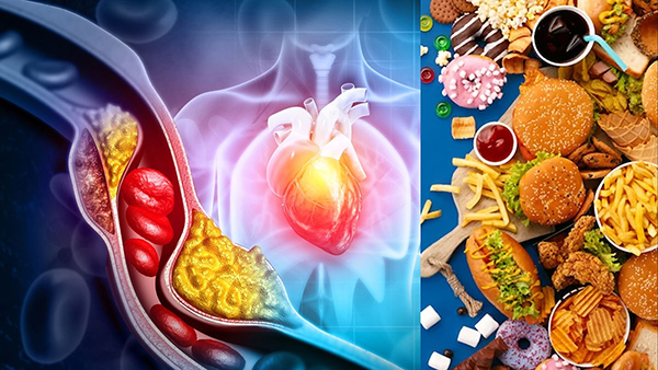 Which winter foods can contribute to high cholesterol level in tamil 