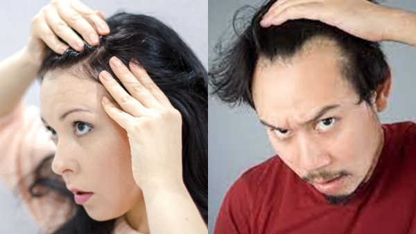 Hair Loss Foods in Tamil: Worst Foods That Could Cause Hair Loss Hair Loss Foods in Tamil: Worst Foods That Could Cause Hair Loss