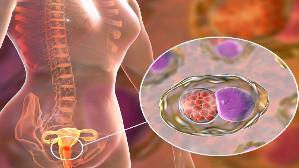 Lifestyle changes that help in preventing cervical cancer in tamil 