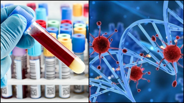 Simple Blood Test Can Detect 18 Early Stage Cancers, Study Shows