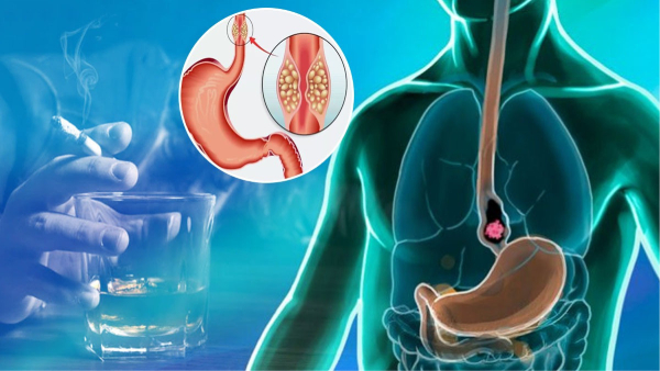  simple changes in your diet that can help prevent cancer in tamil 