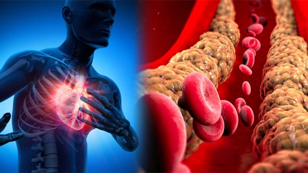 high cholesterol symptoms that can turn into fatal disease in tamil 