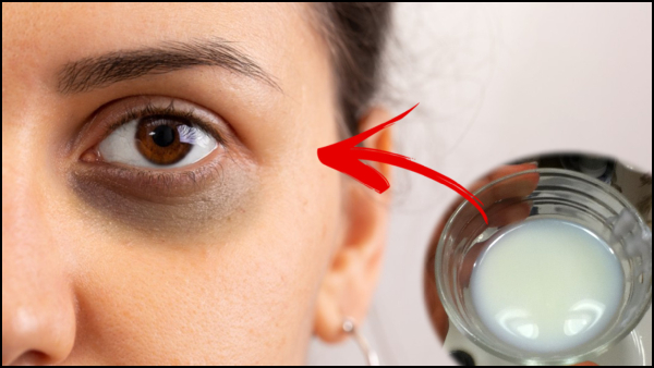 Dark Circles: Homemade DIY Eye Masks to Get Rid of Dark Circles In Tamil Dark Circles: Homemade DIY Eye Masks to Get Rid of Dark Circles In Tamil
