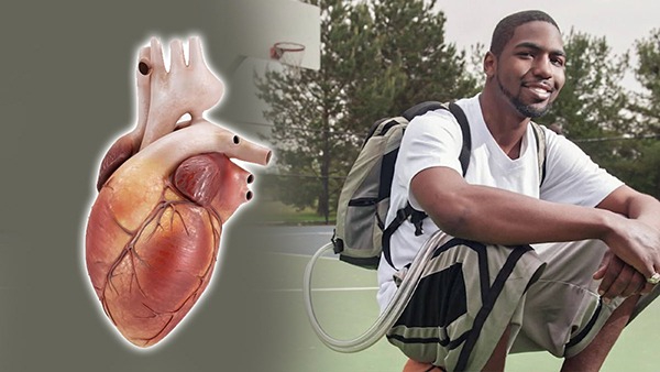 Man Lives 555 Days Without a Heart in Tamil