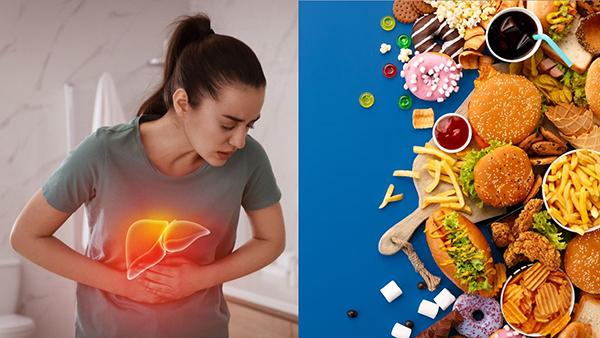  உங்க கல்லீரலுக்கு எந்த ஆபத்தும் ஏற்படாமல் இருக்க இந்த 9 உணவுகள நீங்க சாப்பிடவே கூடாதாம்...!