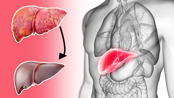 How indulging in fast food can be damaging your liver in tamil 