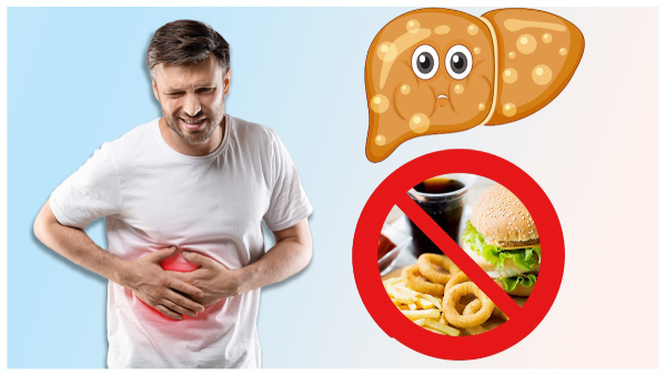 This is responsible for maximum fatty liver cases: Are you at risk in tamil 