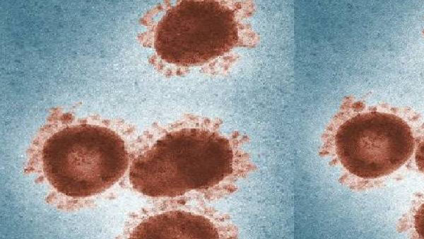 Zombie Virus Which Is In Arctic Could Spark Deadly Pandemic in Tamil