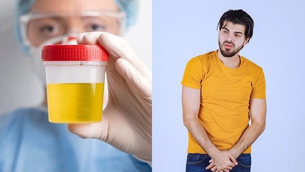 Why the Urine Color Is Yellow in Tamil