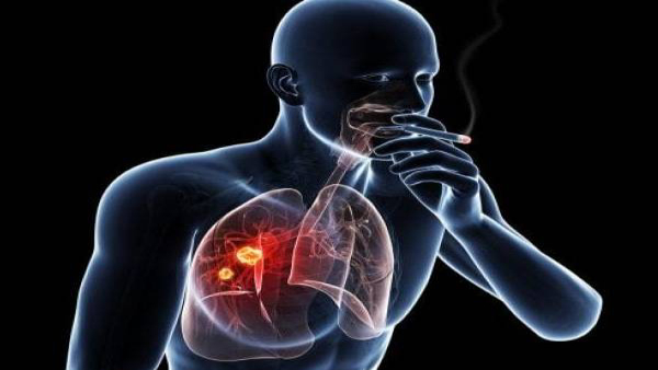 Top 5 actions against Cancer every day Top 5 actions against Cancer every day