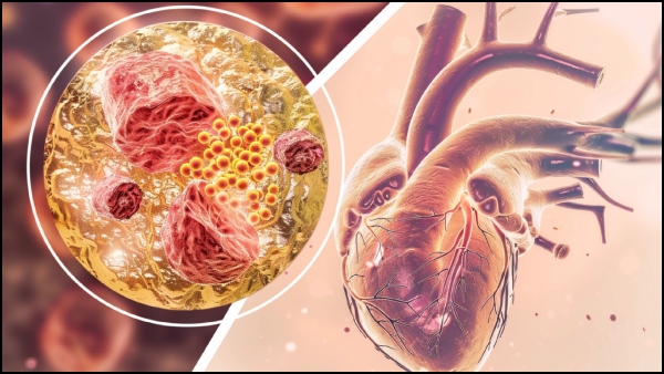 Heart Blockage In Tamil: Ayurvedic Morning Drinks To Clean Arteries Heart Blockage In Tamil: Ayurvedic Morning Drinks To Clean Arteries