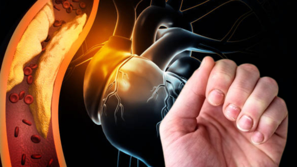 High Cholesterol Symptoms In Tamil: Signs of High Bad LDL Cholesterol Levels On Fingers