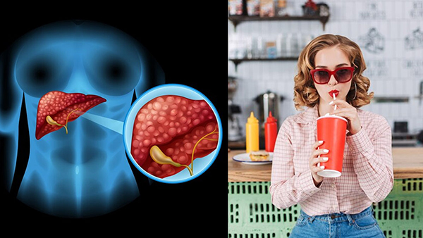 Soft drink consumption linked to liver cancer risk in women in tamil 