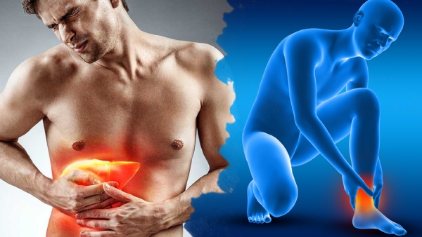 Liver Failure Symptoms In Tamil: Warning Signs Of Liver Failure On Your Legs At Night