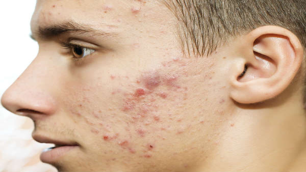 Signs on skin that may be indicative of serious diseases in tamil Signs on skin that may be indicative of serious diseases in tamil