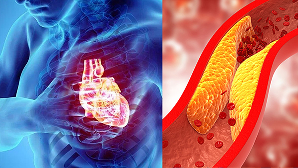 Cholesterol Diet Benefits Of Black Ginger Tea For High Cholesterol Cholesterol Diet Benefits Of Black Ginger Tea For High Cholesterol