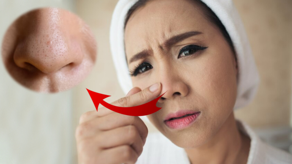 Skin Care Tips Top 5 Homemade Face Packs To Get Rid Of Blackheads In Tamil