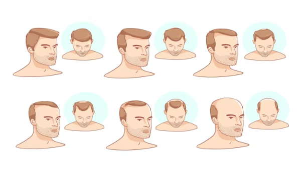 Hair Care Tips Bad Food Habits That Cause Hair Fall in Tamil