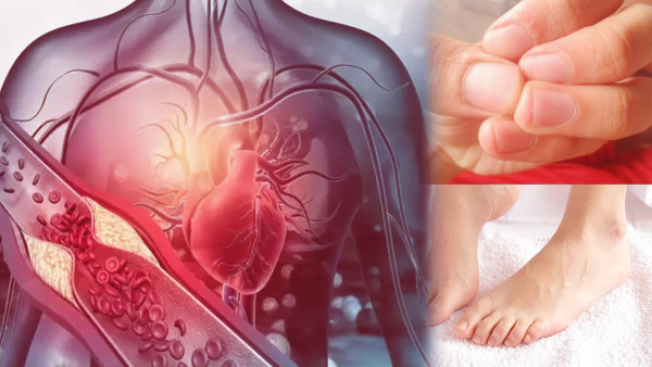 High Cholesterol Symptoms in Men in Tamil