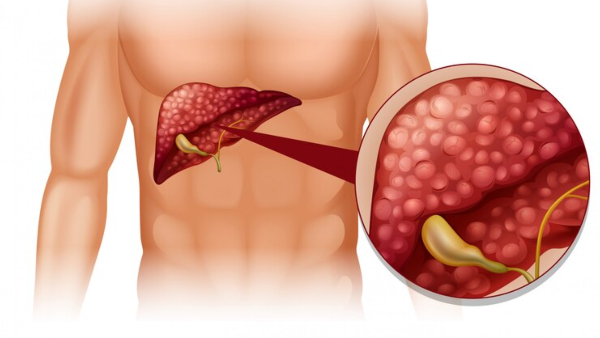 Exercise And Liver Enzymes Can Exercise Affect Liver Enzymes In Tamil