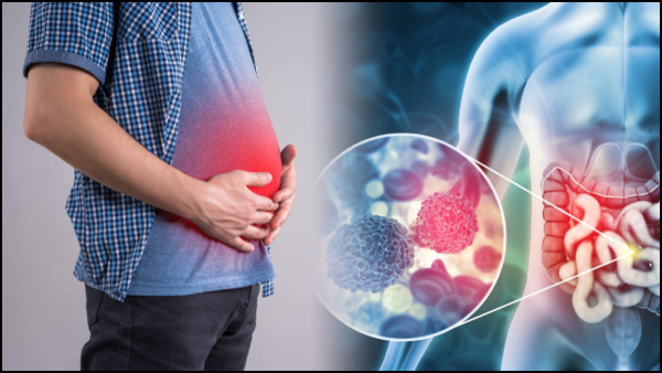 Prostate Cancer Who Is At Risk for Prostate Cancer in Tamil