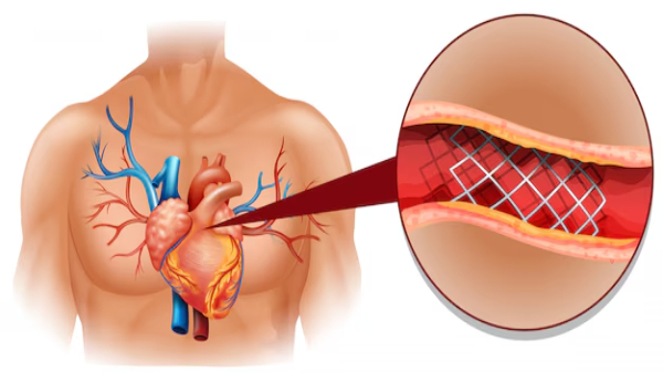 Heart Health Symptoms of Heart Blockage in Tamil