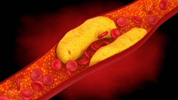 High Cholesterol Vitamin B12 Rich Vegetables To Flush Out Bad Cholesterol In Tamil