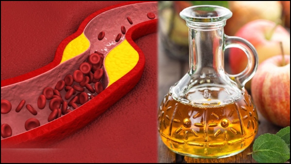 High Cholesterol Drinking Apple Cider Vinegar and Chia Seeds Helps In Lowering Bad Cholesterol Levels