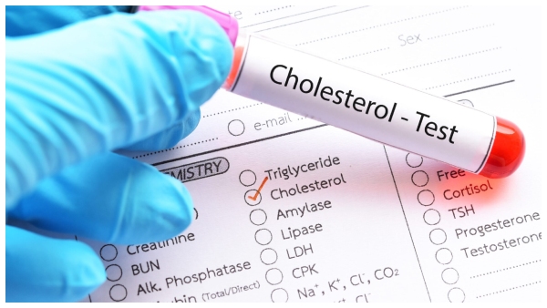 8 home remedies to lower high cholesterol
