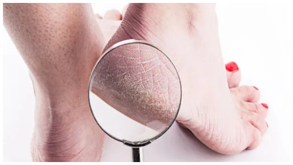 vinegar water feet soak how to make it and its benefits