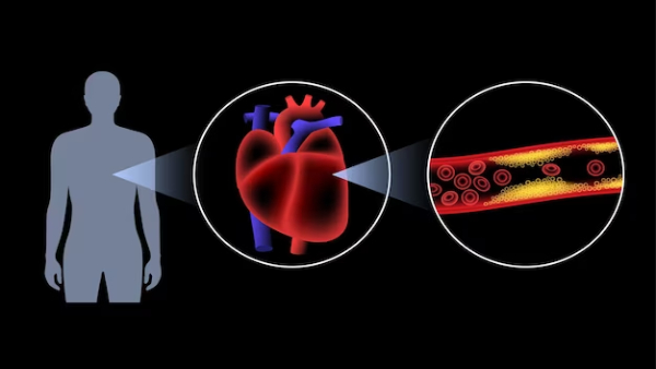 Heart Health Ayurvedic Drinks To Clear Blocked Arteries in Tamil