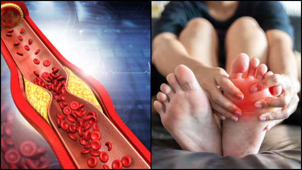 High Cholesterol Symptoms In Tamil Unusual Signs of High Bad Cholesterol In Legs And Fingers At Night