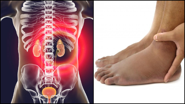 Kidney Disease Symptoms In Tamil Signs Of Kidney Disease On Feet