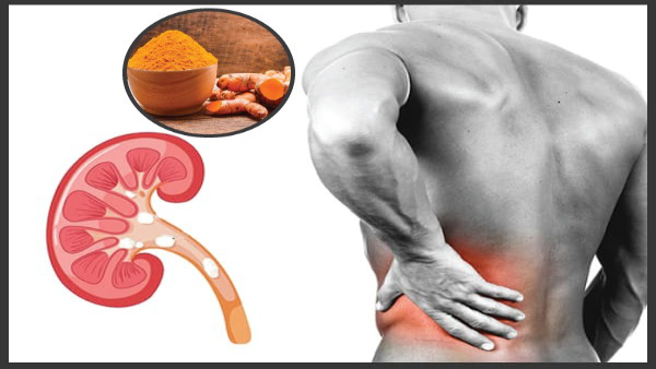 Why Turmeric Is Bad for Kidney Patients in Tamil