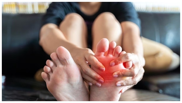 home remedies and foods to eat to control high uric acid level naturally