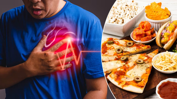 Heart Blockage Foods That Can Create Heart Arteries And Cause Stroke