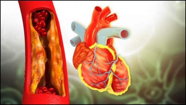 Heart Blockage Top 5 Seeds to Boost Heart Health and Clean Artery Blockages In Tamil Heart Blockage Top 5 Seeds to Boost Heart Health and Clean Artery Blockages In Tamil