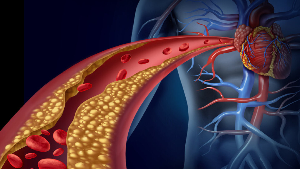 Heart Health Ayurvedic Drinks To Clean Heart Arteries And Prevent Summer Stroke