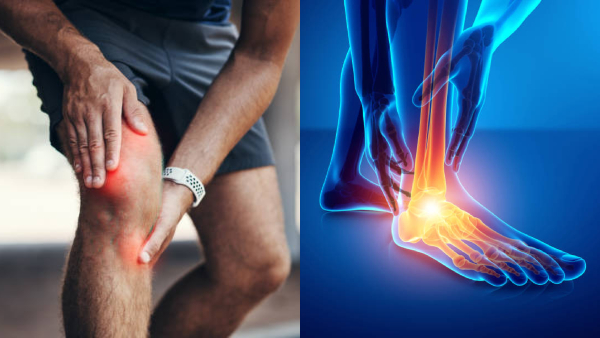 Edema In Tamil This One Sign Can Be The Symptoms Of 3 Deadly Diseases