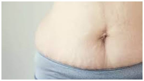 Tips for reduce belly and weight after pregnancy