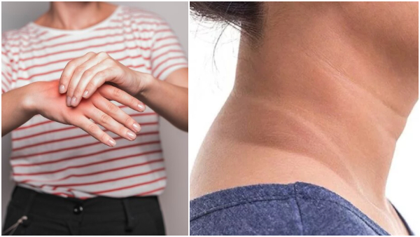 Diabetes Symptoms In Tamil Unusual Signs Of Diabetes You Must Not Ignore Diabetes Symptoms In Tamil Unusual Signs Of Diabetes You Must Not Ignore