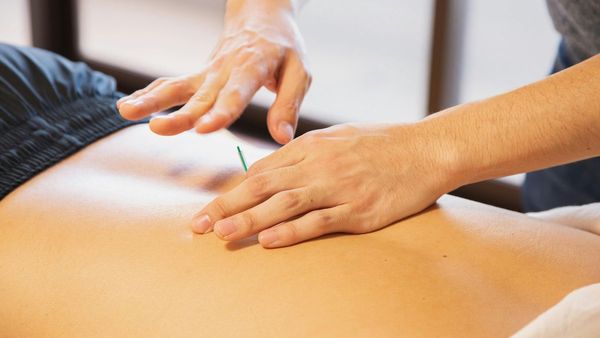 Benefits Of Acupuncture For Treating Back Pain