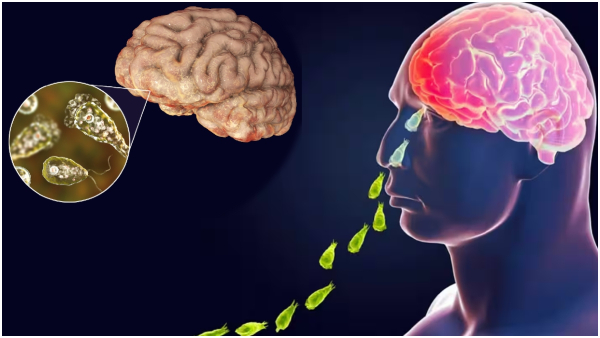 Brain-Eating Amoeba Killed 2 Kids In Kerala Here s All You Need To Know About It