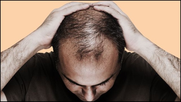 Hair Fall Solution Top 5 Best Supplements For Men To Stop Extreme Hair Fall In Tamil