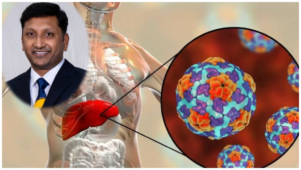 Exclusive Doctor Explains Hepatitis A Symptoms Causes Transmission Prevention